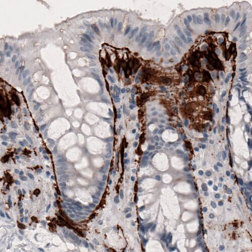 Coagulation Factor III/Tissue Factor Antibody (CL3807) - Azide and BSA Free Immunohistochemistry-Paraffin: Coagulation Factor III/Tissue Factor Antibody [NBP3-44078]