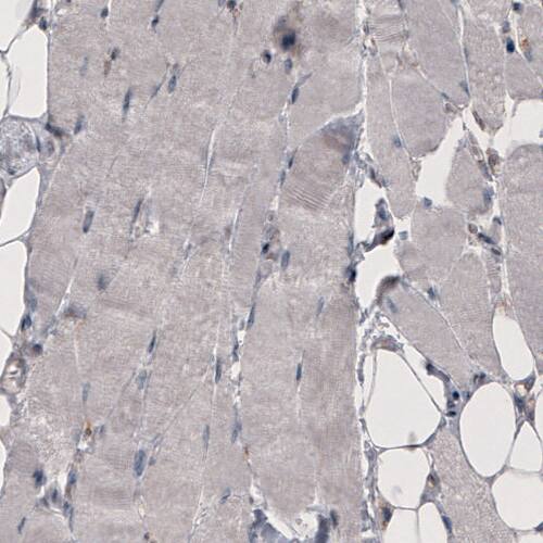 Coagulation Factor III/Tissue Factor Antibody (CL3807) - Azide and BSA Free Immunohistochemistry-Paraffin: Coagulation Factor III/Tissue Factor Antibody [NBP3-44078]
