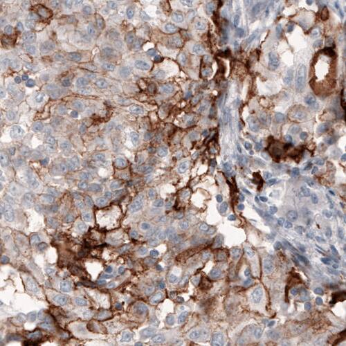 Coagulation Factor III/Tissue Factor Antibody (CL3807) - Azide and BSA Free Immunohistochemistry-Paraffin: Coagulation Factor III/Tissue Factor Antibody [NBP3-44078]