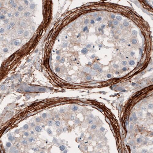 Coagulation Factor III/Tissue Factor Antibody (CL3807) - Azide and BSA Free Immunohistochemistry-Paraffin: Coagulation Factor III/Tissue Factor Antibody [NBP3-44078]
