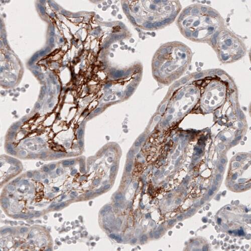 Coagulation Factor III/Tissue Factor Antibody (CL3807) - Azide and BSA Free Immunohistochemistry-Paraffin: Coagulation Factor III/Tissue Factor Antibody [NBP3-44078]