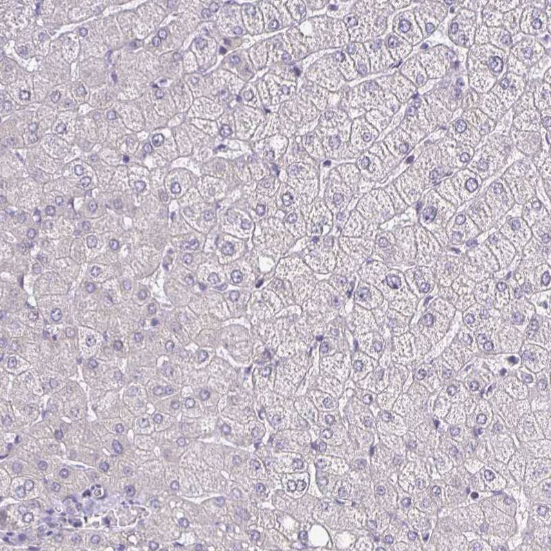 ErbB2/Her2 Antibody (CL0268) - Azide and BSA Free Immunohistochemistry-Paraffin: ErbB2/Her2 Antibody [NBP3-44084]