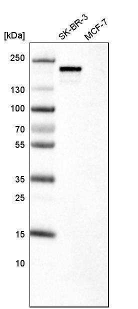 ErbB2/Her2 Antibody (CL0268) - Azide and BSA Free Western Blot: ErbB2/Her2 Antibody [NBP3-44084]