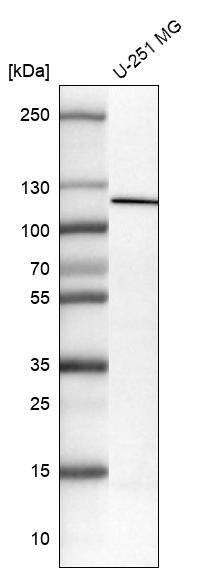 NLRP3/NALP3 Antibody (CL0210) - Azide and BSA Free Western Blot: NLRP3/NALP3 Antibody [NBP3-44085]