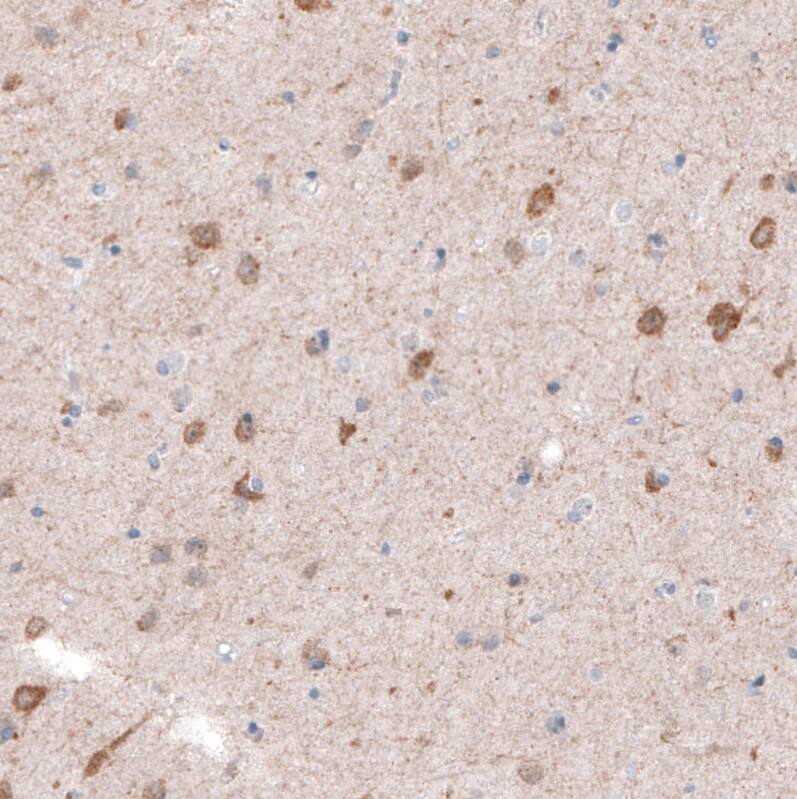 CDKL5 Antibody (CL4881) - Azide and BSA Free Immunohistochemistry-Paraffin: CDKL5 Antibody [NBP3-44086]