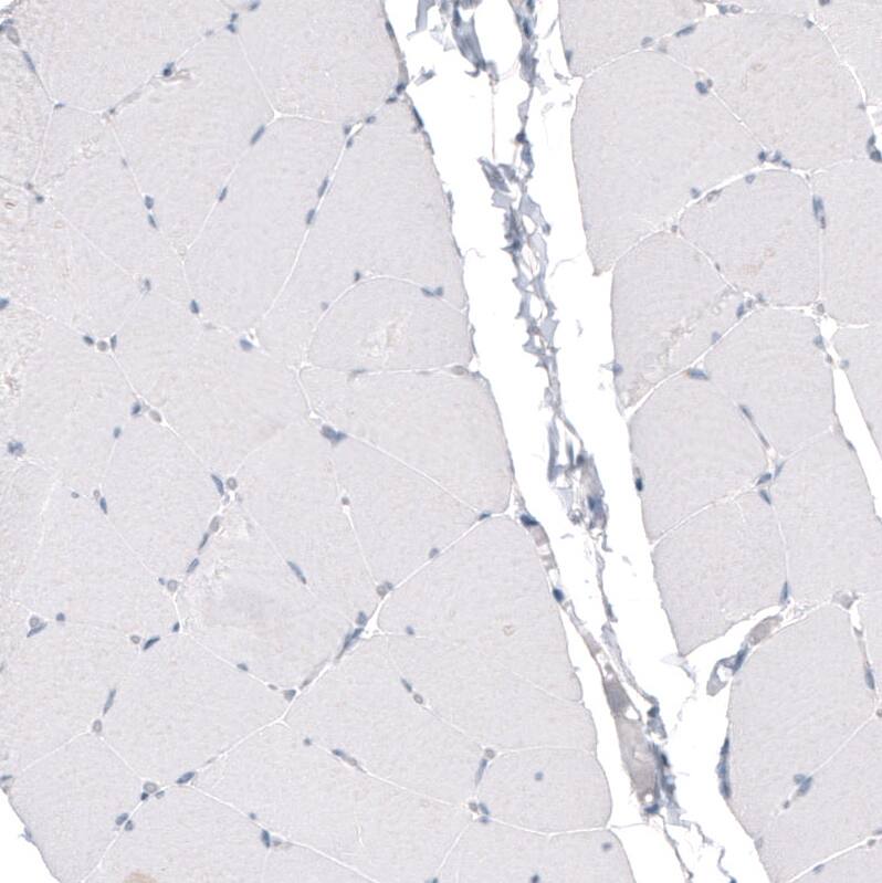 CDKL5 Antibody (CL4881) - Azide and BSA Free Immunohistochemistry-Paraffin: CDKL5 Antibody [NBP3-44086]