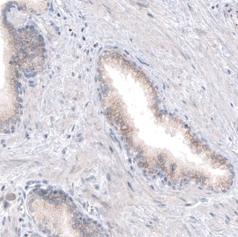 CDKL5 Antibody (CL4881) - Azide and BSA Free Immunohistochemistry-Paraffin: CDKL5 Antibody [NBP3-44086]