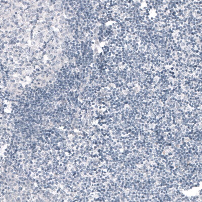 CDKL5 Antibody (CL4881) - Azide and BSA Free Immunohistochemistry-Paraffin: CDKL5 Antibody [NBP3-44086]