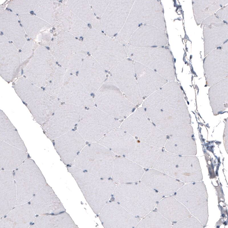 CDKL5 Antibody (CL4888) - Azide and BSA Free Immunohistochemistry-Paraffin: CDKL5 Antibody [NBP3-44087]