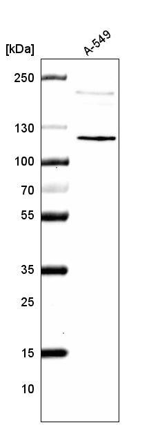 CDKL5 Antibody (CL4888) - Azide and BSA Free Western Blot: CDKL5 Antibody [NBP3-44087]