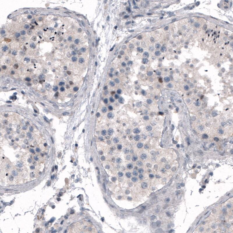 CDKL5 Antibody (CL4888) - Azide and BSA Free Immunohistochemistry-Paraffin: CDKL5 Antibody [NBP3-44087]