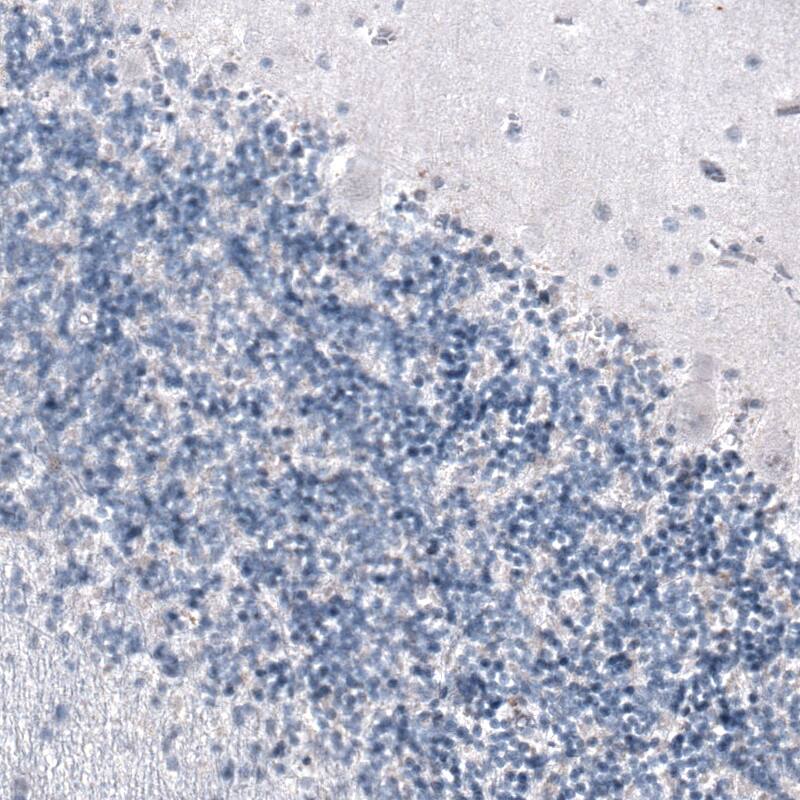 SMCHD1 Antibody (CL4265) - Azide and BSA Free Immunohistochemistry-Paraffin: SMCHD1 Antibody [NBP3-44088]