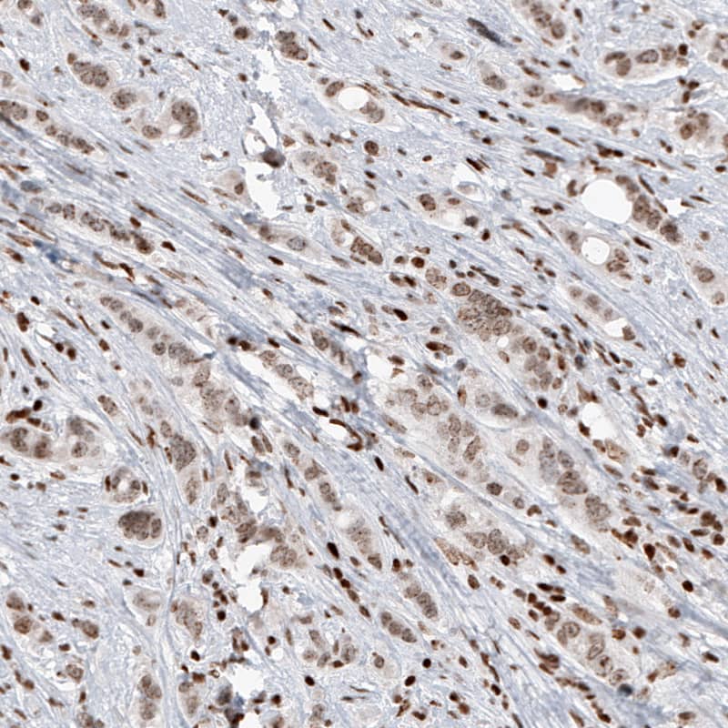 SMCHD1 Antibody (CL4265) - Azide and BSA Free Immunohistochemistry-Paraffin: SMCHD1 Antibody [NBP3-44088]