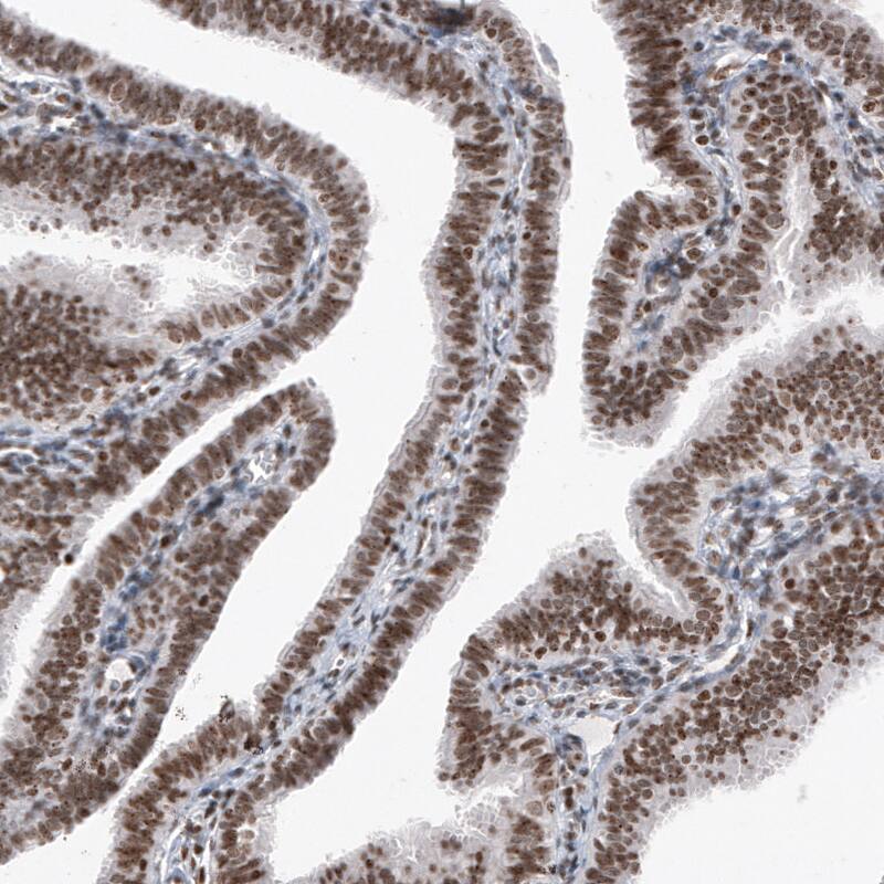 SMCHD1 Antibody (CL4265) - Azide and BSA Free Immunohistochemistry-Paraffin: SMCHD1 Antibody [NBP3-44088]