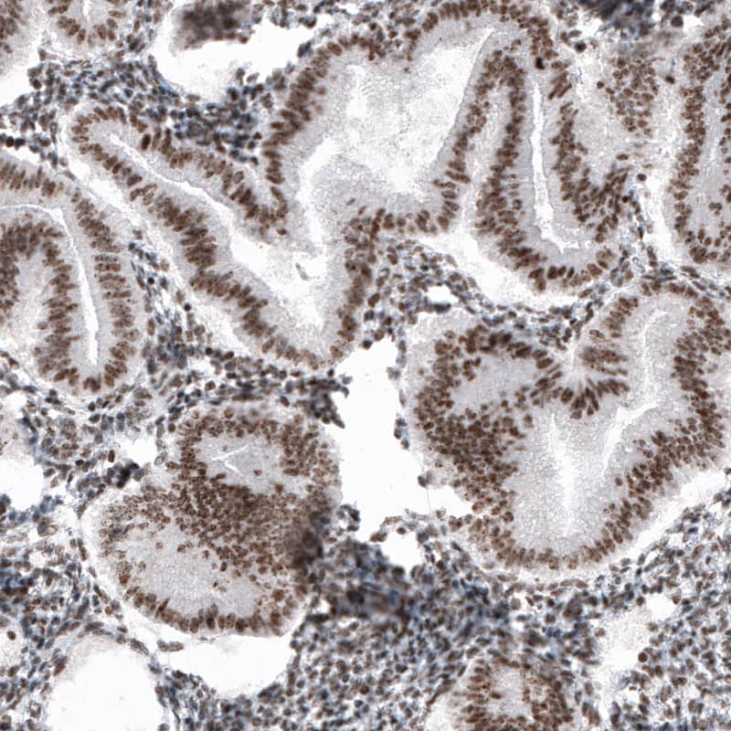 SMCHD1 Antibody (CL4265) - Azide and BSA Free Immunohistochemistry-Paraffin: SMCHD1 Antibody [NBP3-44088]