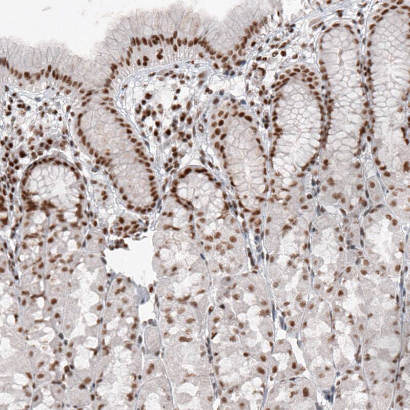 SMCHD1 Antibody (CL4265) - Azide and BSA Free Immunohistochemistry-Paraffin: SMCHD1 Antibody [NBP3-44088]