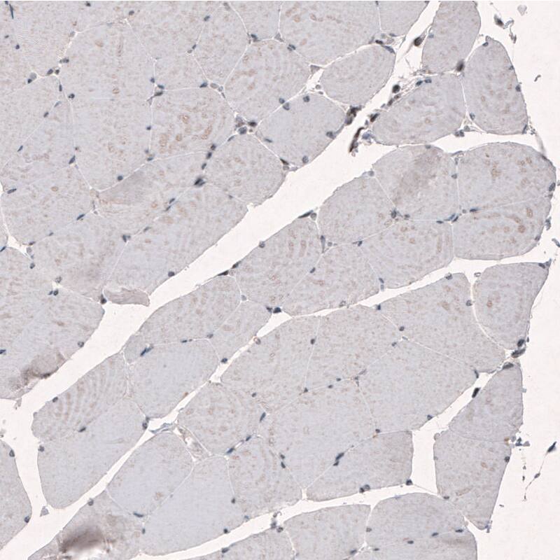 SMCHD1 Antibody (CL4270) - Azide and BSA Free Immunohistochemistry-Paraffin: SMCHD1 Antibody [NBP3-44089]