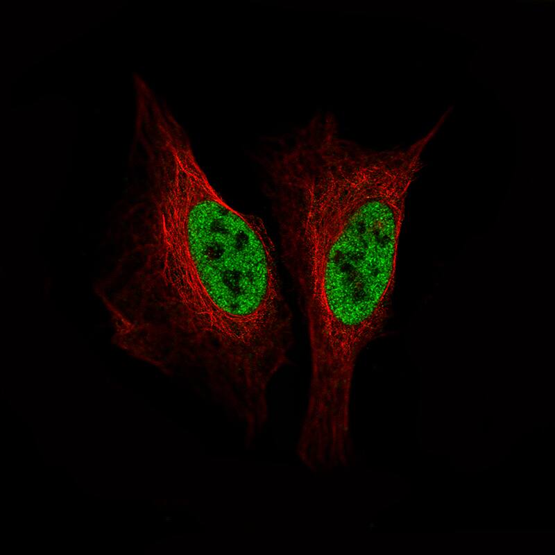 SMCHD1 Antibody (CL4270) - Azide and BSA Free Immunocytochemistry/ Immunofluorescence: SMCHD1 Antibody [NBP3-44089]