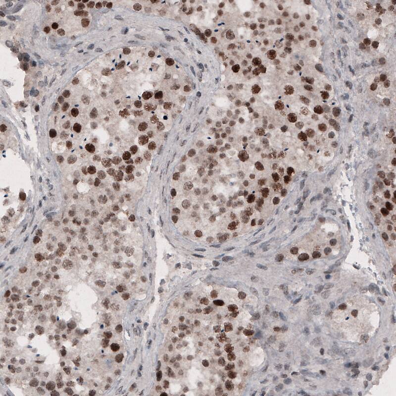 SMCHD1 Antibody (CL4270) - Azide and BSA Free Immunohistochemistry-Paraffin: SMCHD1 Antibody [NBP3-44089]