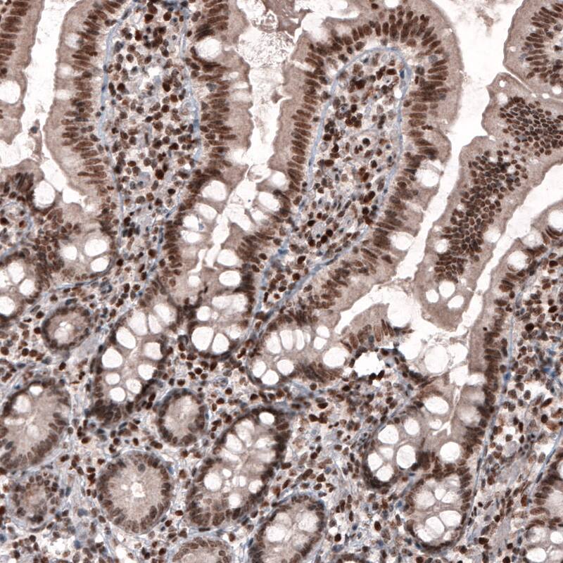 SMCHD1 Antibody (CL4270) - Azide and BSA Free Immunohistochemistry-Paraffin: SMCHD1 Antibody [NBP3-44089]