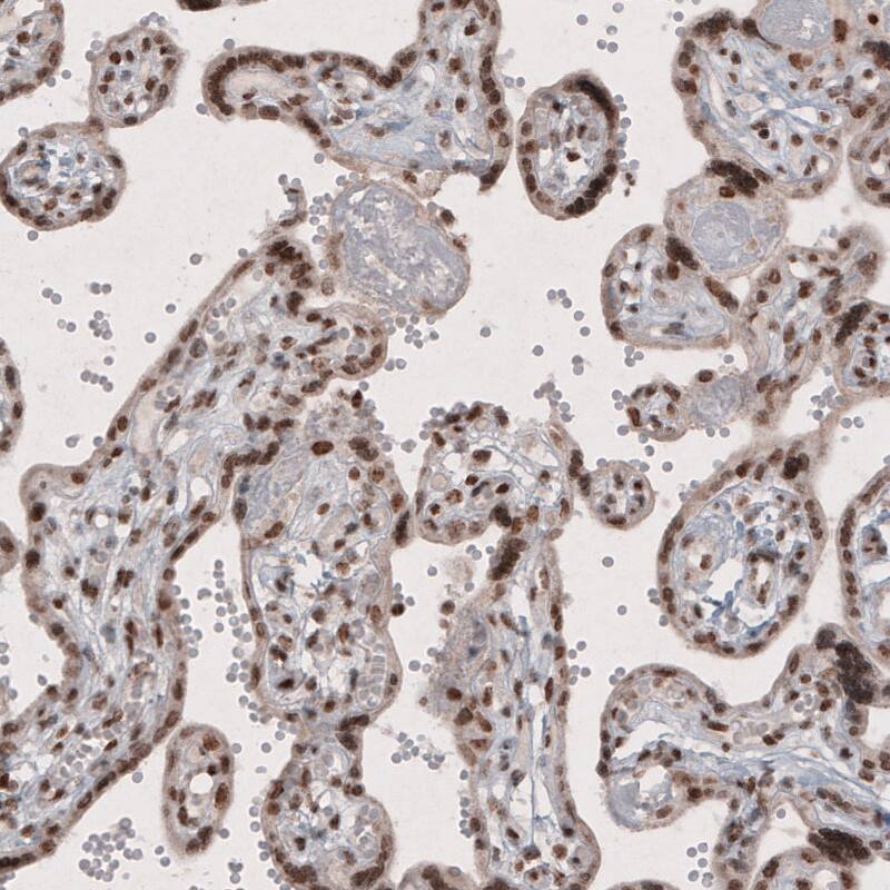 SMCHD1 Antibody (CL4270) - Azide and BSA Free Immunohistochemistry-Paraffin: SMCHD1 Antibody [NBP3-44089]