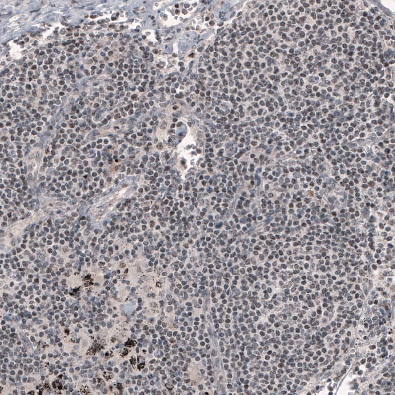 SMCHD1 Antibody (CL4270) - Azide and BSA Free Immunohistochemistry-Paraffin: SMCHD1 Antibody [NBP3-44089]