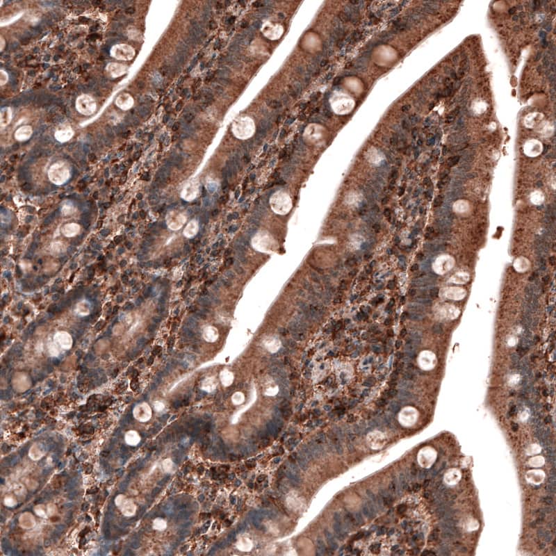 LAMP-1/CD107a Antibody (CL4463) - Azide and BSA Free Immunohistochemistry-Paraffin: LAMP-1/CD107a Antibody [NBP3-44090]