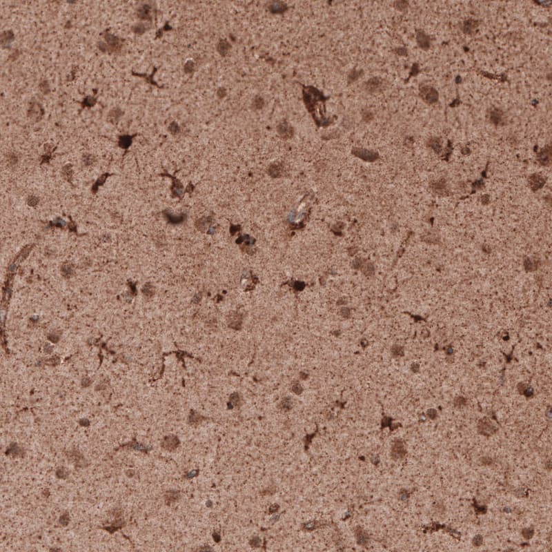 LAMP-1/CD107a Antibody (CL4463) - Azide and BSA Free Immunohistochemistry-Paraffin: LAMP-1/CD107a Antibody [NBP3-44090]