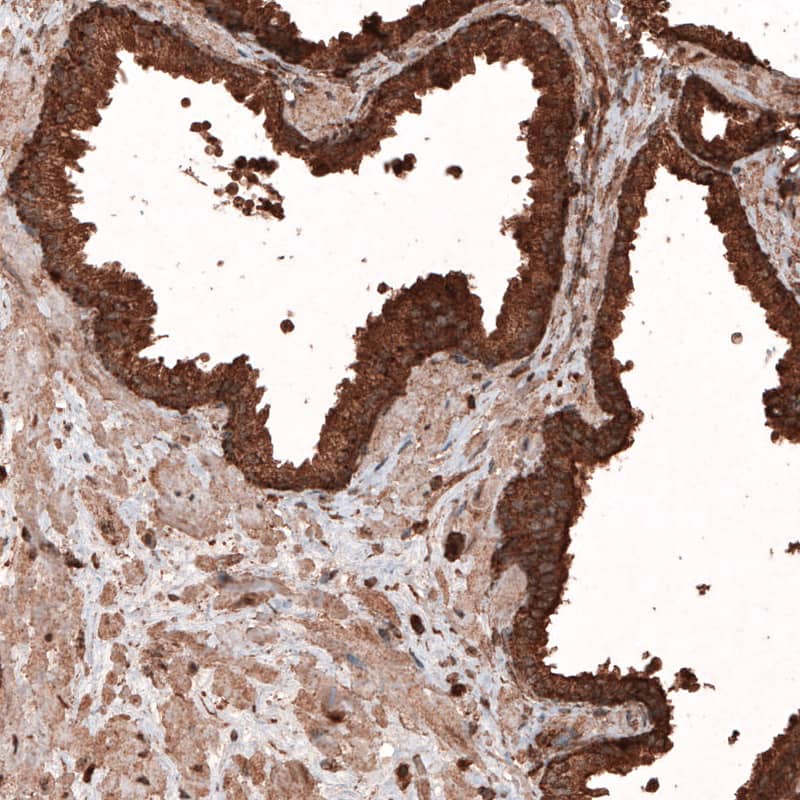 LAMP-1/CD107a Antibody (CL4463) - Azide and BSA Free Immunohistochemistry-Paraffin: LAMP-1/CD107a Antibody [NBP3-44090]