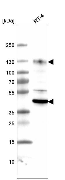 LAMP-1/CD107a Antibody (CL4463) - Azide and BSA Free Western Blot: LAMP-1/CD107a Antibody [NBP3-44090]