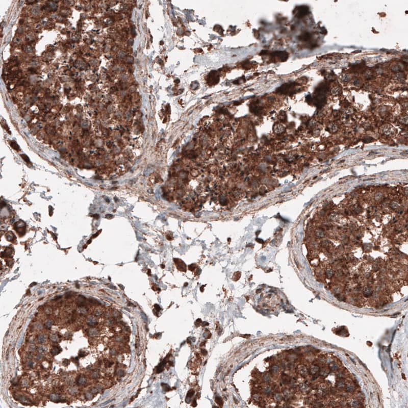 LAMP-1/CD107a Antibody (CL4463) - Azide and BSA Free Immunohistochemistry-Paraffin: LAMP-1/CD107a Antibody [NBP3-44090]