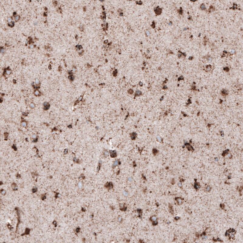 LAMP-1/CD107a Antibody (CL4472) - Azide and BSA Free Immunohistochemistry-Paraffin: LAMP-1/CD107a Antibody [NBP3-44091]