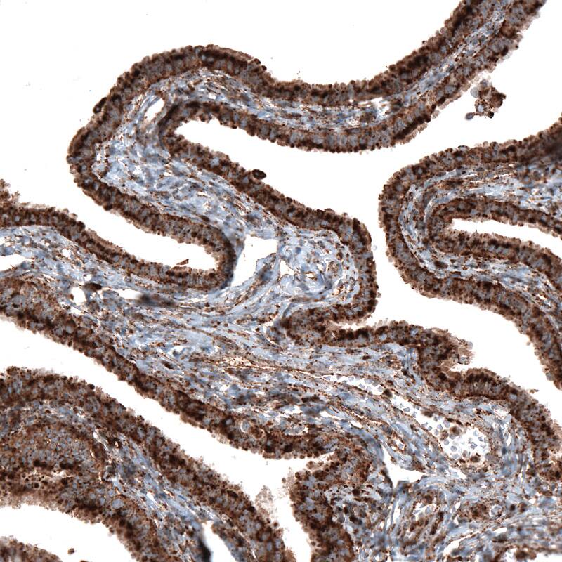 LAMP-1/CD107a Antibody (CL4472) - Azide and BSA Free Immunohistochemistry-Paraffin: LAMP-1/CD107a Antibody [NBP3-44091]