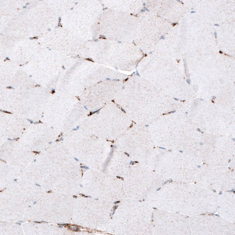 LAMP-1/CD107a Antibody (CL4472) - Azide and BSA Free Immunohistochemistry-Paraffin: LAMP-1/CD107a Antibody [NBP3-44091]