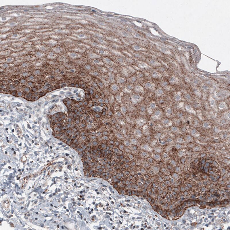 LAMP-1/CD107a Antibody (CL4489) - Azide and BSA Free Immunohistochemistry-Paraffin: LAMP-1/CD107a Antibody [NBP3-44092]