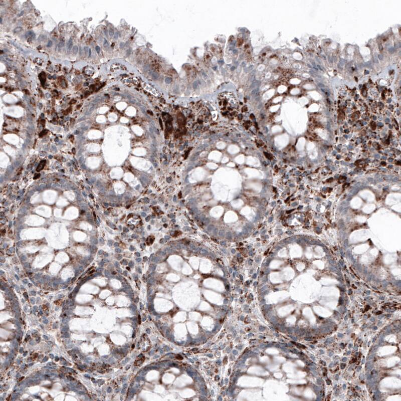 LAMP-1/CD107a Antibody (CL4489) - Azide and BSA Free Immunohistochemistry-Paraffin: LAMP-1/CD107a Antibody [NBP3-44092]