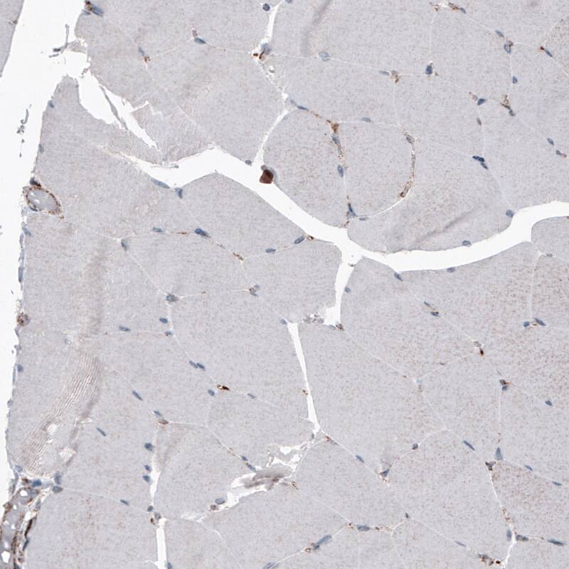 LAMP-1/CD107a Antibody (CL4489) - Azide and BSA Free Immunohistochemistry-Paraffin: LAMP-1/CD107a Antibody [NBP3-44092]