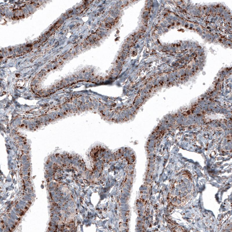 LAMP-1/CD107a Antibody (CL4490) - Azide and BSA Free Immunohistochemistry-Paraffin: LAMP-1/CD107a Antibody [NBP3-44093]