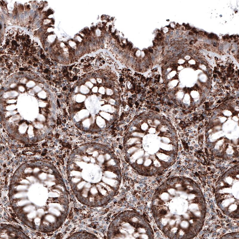 LAMP-1/CD107a Antibody (CL4490) - Azide and BSA Free Immunohistochemistry-Paraffin: LAMP-1/CD107a Antibody [NBP3-44093]