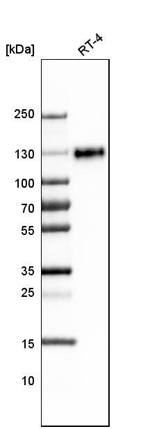 LAMP-1/CD107a Antibody (CL4490) - Azide and BSA Free Western Blot: LAMP-1/CD107a Antibody [NBP3-44093]
