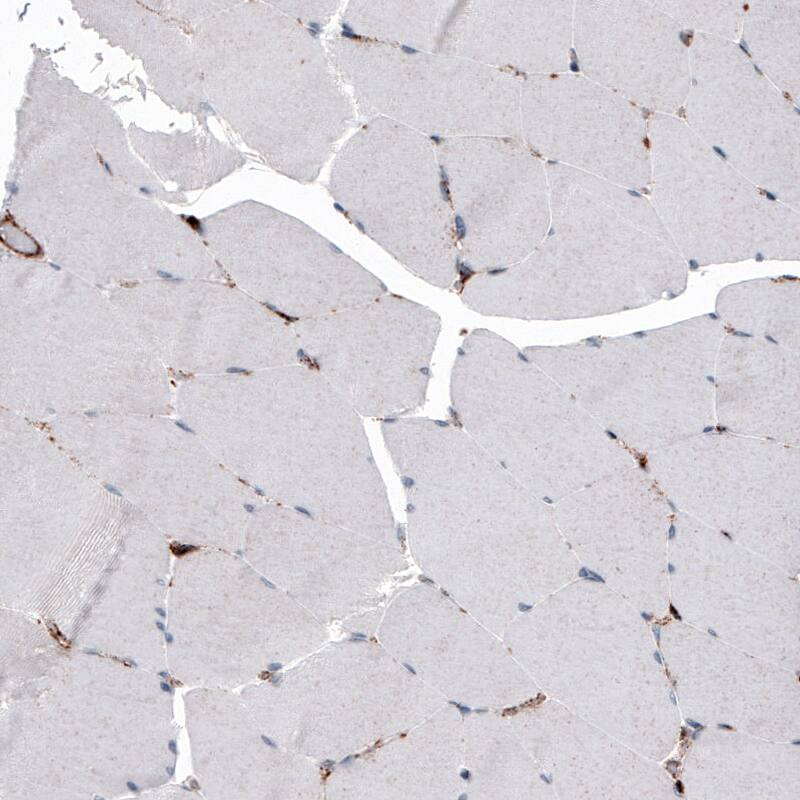 LAMP-1/CD107a Antibody (CL4490) - Azide and BSA Free Immunohistochemistry-Paraffin: LAMP-1/CD107a Antibody [NBP3-44093]