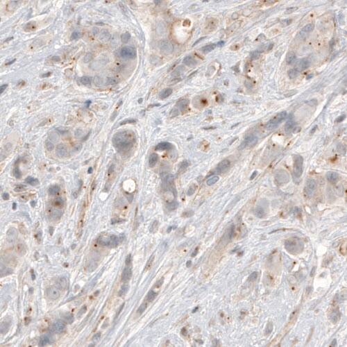 CDK5RAP2 Antibody (CL3392) - Azide and BSA Free Immunohistochemistry-Paraffin: CDK5RAP2 Antibody [NBP3-44094]