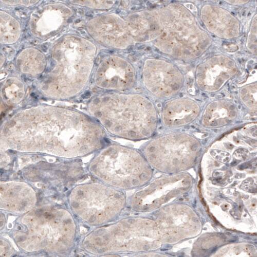 CDK5RAP2 Antibody (CL3392) - Azide and BSA Free Immunohistochemistry-Paraffin: CDK5RAP2 Antibody [NBP3-44094]