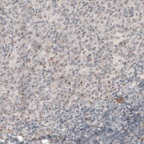 CDK5RAP2 Antibody (CL3392) - Azide and BSA Free Immunohistochemistry-Paraffin: CDK5RAP2 Antibody [NBP3-44094]