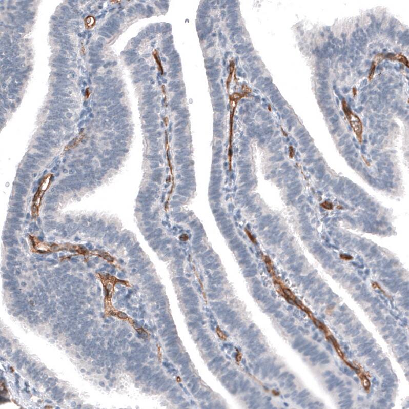 ELTD1/ETL Antibody (CL4164) - Azide and BSA Free Immunohistochemistry-Paraffin: ELTD1/ETL Antibody [NBP3-44095]