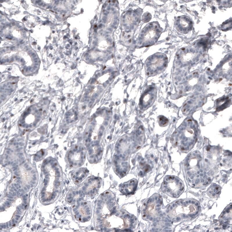 Mkl1 Antibody (CL4281) - Azide and BSA Free Immunohistochemistry-Paraffin: Mkl1 Antibody [NBP3-44096]