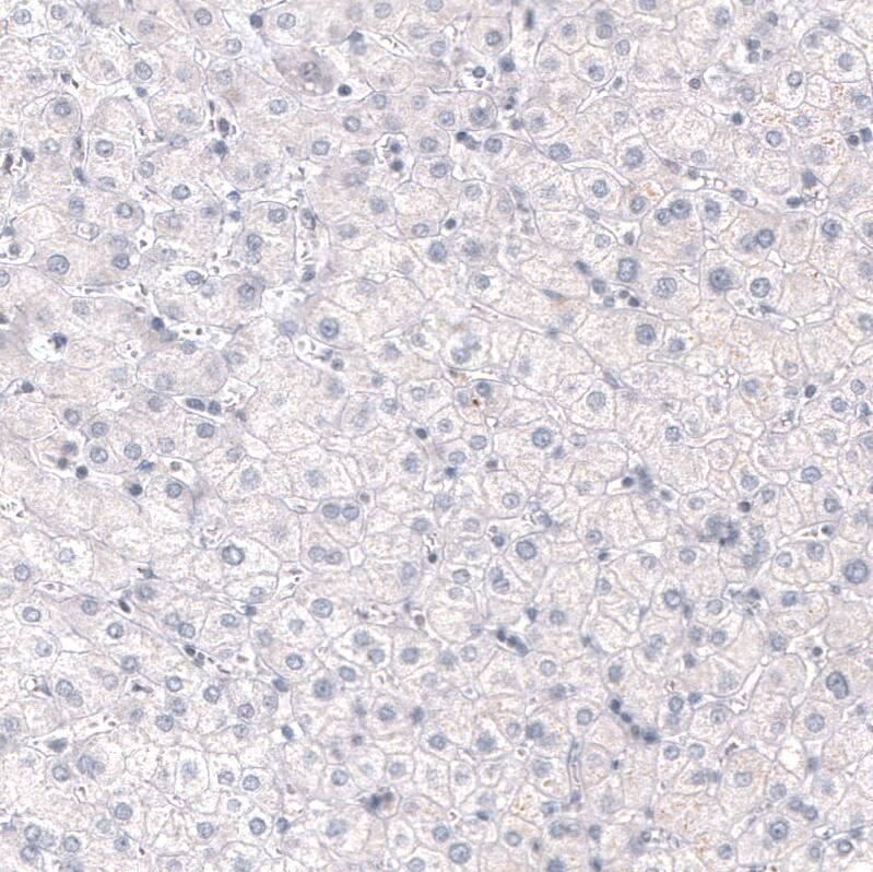 Mkl1 Antibody (CL4281) - Azide and BSA Free Immunohistochemistry-Paraffin: Mkl1 Antibody [NBP3-44096]