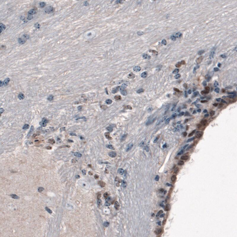 SOX21 Antibody (CL4681) - Azide and BSA Free Immunohistochemistry-Paraffin: SOX21 Antibody [NBP3-44097]