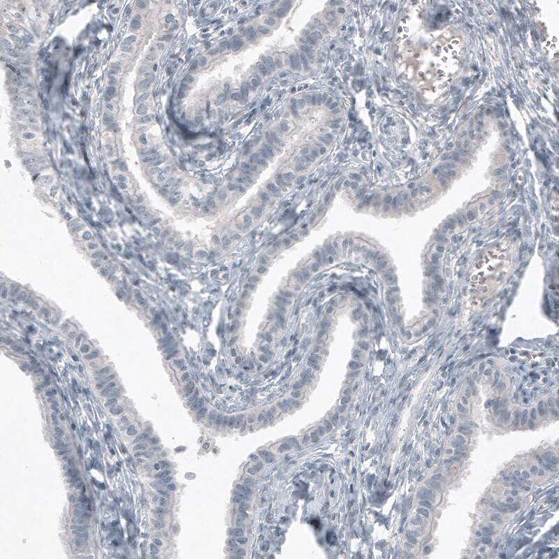 SOX21 Antibody (CL4688) - Azide and BSA Free Immunohistochemistry-Paraffin: SOX21 Antibody [NBP3-44098]