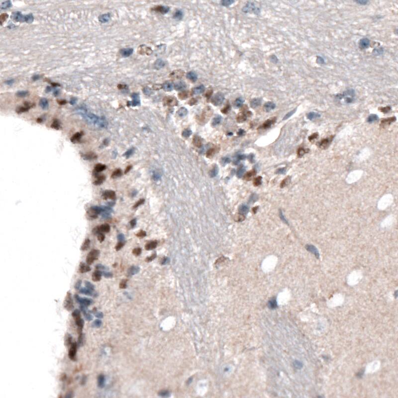 SOX21 Antibody (CL4688) - Azide and BSA Free Immunohistochemistry-Paraffin: SOX21 Antibody [NBP3-44098]